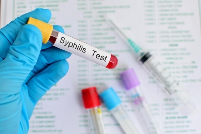 Syphilis Incidence in Ulyanovsk Region Increases by 40%: New Report from Ulyanovskstat