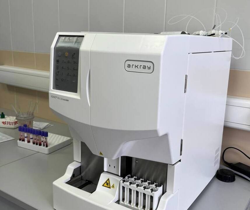 Шесть больниц Ульяновской области получили оборудование для выявления диабета