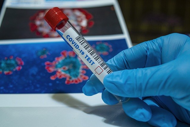 158 ульяновцев побороли коронавирус: данные на 25 августа